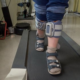 Gehtraining Die Beine einer Person, die sich auf einem Laufband fortbewegt.